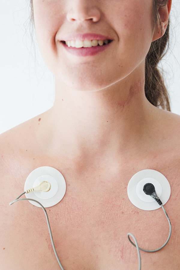 Holter Monitoring